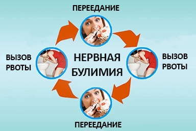 Лечение булимии в Первомайском